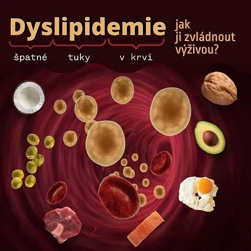 Dyslipidemie: jak ji zvládnout výživou? - Nutriční poradna
