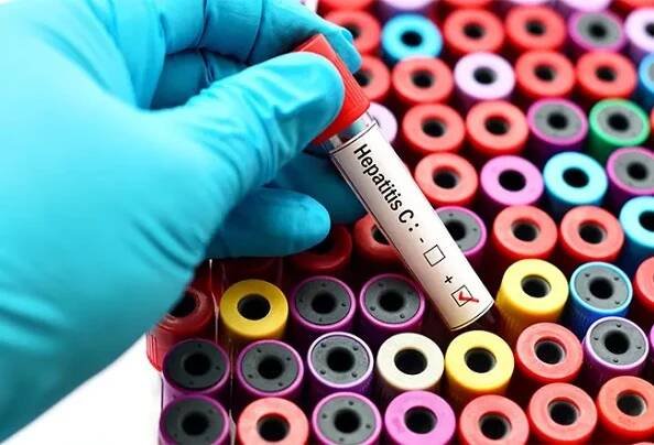 Hepatitis C Cure Costs, Treatment Drugs, Side Effects