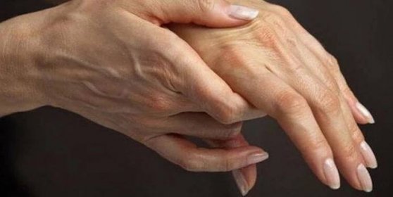 Bolest kloubů prstů: příčiny a léčba, co dělat, když bolí klouby prstů