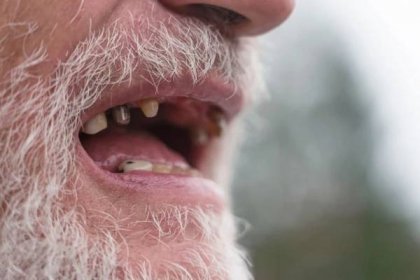 mužská ústa se špatnými zuby - kurděje - stock snímky, obrázky a fotky