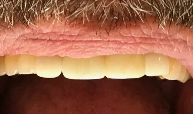 Smile Gallery - Eastport Dental AZ