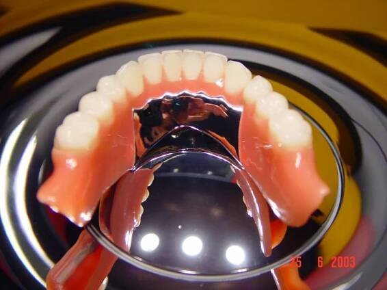 Totální a částečné protézy :: Dentalpraxis.cz