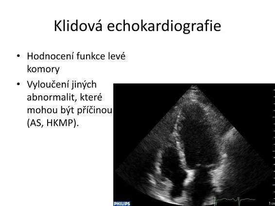 PPT - Ateroskleróza a Stabilní ischemická choroba srdeční PowerPoint Presentation - ID:2107527