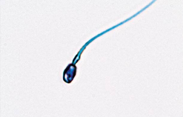 Chromatin-Status │ © 2024 Next Fertility IVF Prof. Zech