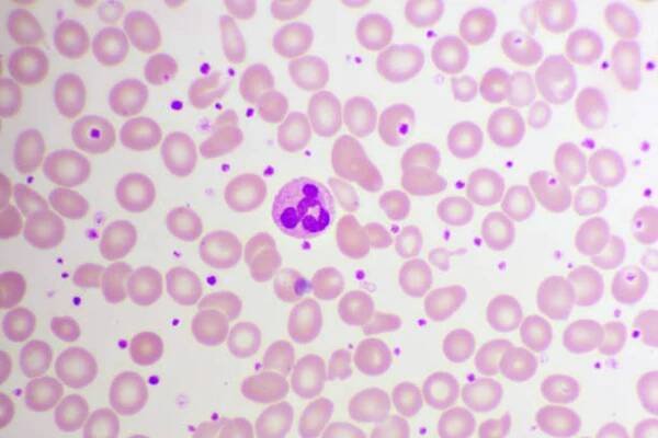 esenciální krevní nátěr trombocytózy - haematopoiesis - stock snímky, obrázky a fotky