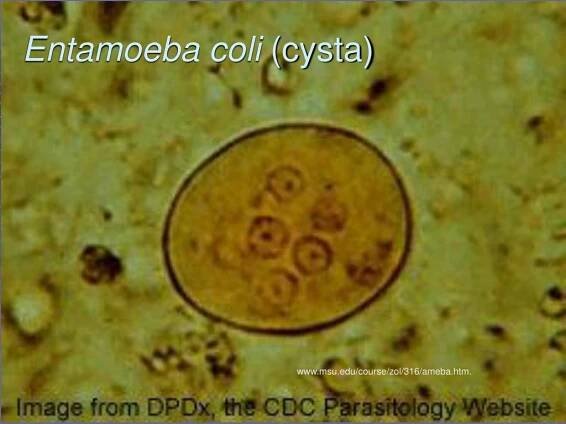 PPT - Lékařská mikrobiologie pro ZDRL PowerPoint Presentation, free download - ID:6149225