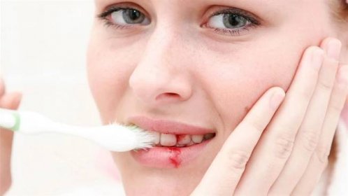 Krvácení dásní může přerůst v parodontitidu. Jak se mu vyhnout?