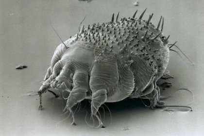 Jak svrab vypadá: fotografie a popis, příznaky onemocnění, diagnostika a metody léčby onemocnění - Bez švábů