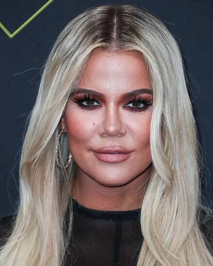 Je to vážně ona? Khloé Kardashian prošla obrovskou proměnou. Co dokážou injekce a filtry?