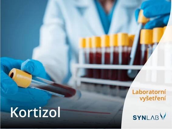 Kortizol Laboratorní test