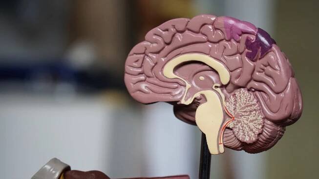 Účinnost hloubkové stimulace mozku u parkinsoniků bude efektivnější