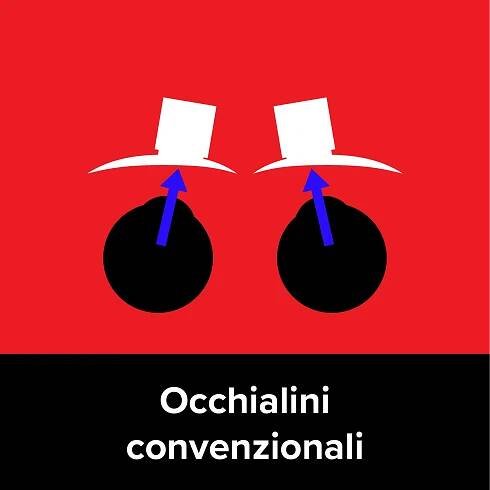 Conventional Loupes
