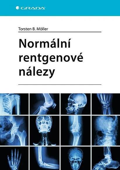 Kniha Normální rentgenové nálezy