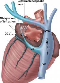 Coronary Venous Anatomy Lao View Diagram Quizlet Images