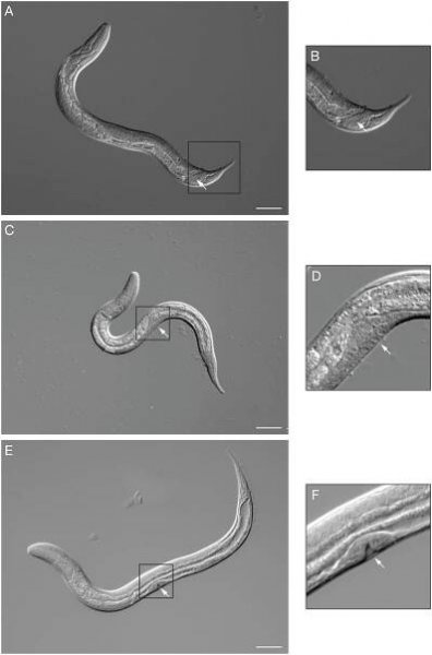 SIntroFIG 6: S. stercoralis free-living larvae. 