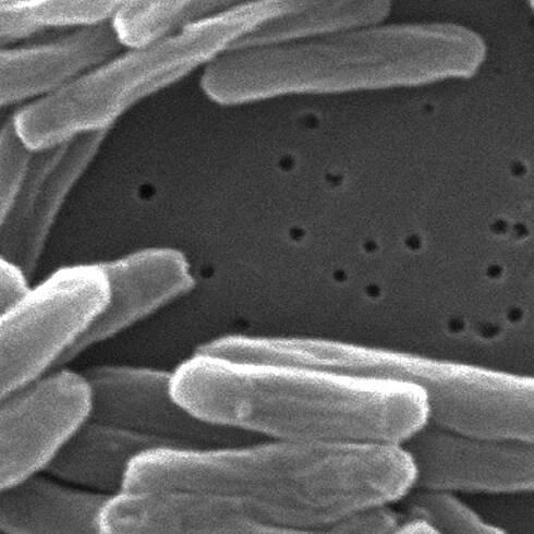 Keime schnell identifiziert: Krankheitserreger in Minuten statt Tagen erkennen