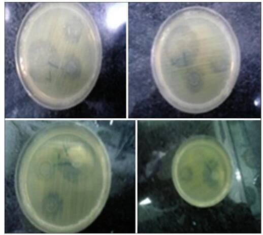 Pseudomonas Aeruginosa in solid media. Different concentrations of nanoparticles were used namely 