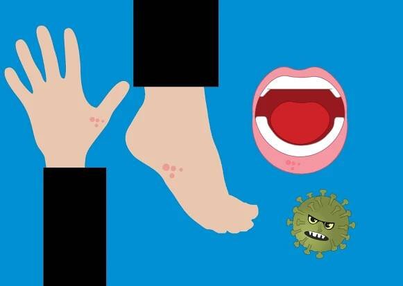 Chodidla choroby: Jak chránit nohy před různými onemocněními » Svobodná Chůze