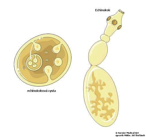 Echinokok - tasemnice liščí | Medicína, nemoci, studium na 1. LF UK