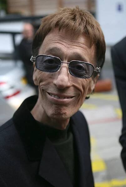 Robin Gibb z Bee Gees zemřel. Zabila ho rakovina