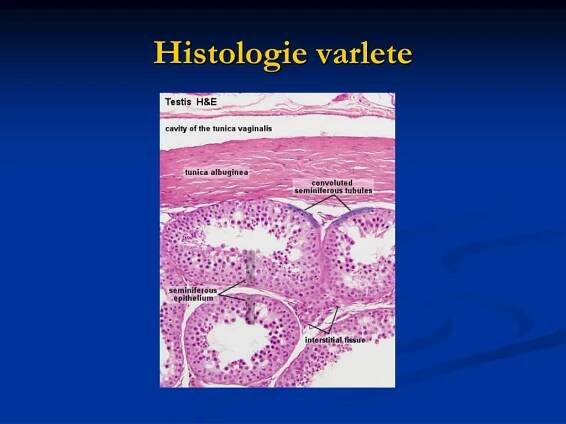 PPT - NÁDORY VARLAT A OVÁRIÍ PowerPoint Presentation, free download - ID:4598887