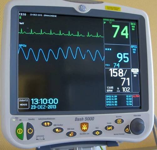 Soubor:Dash 5000 Medical monitor.jpg – Wikipedie