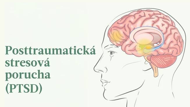Posttraumatická stresová porucha: Příznaky, příčiny, léčba a přírodní přístupy