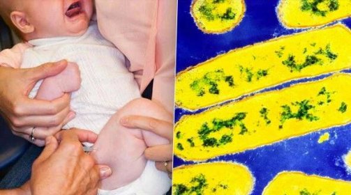 Zákeřná bakterie zabíjí děti. Hemofilus se může projevit i u dospělých