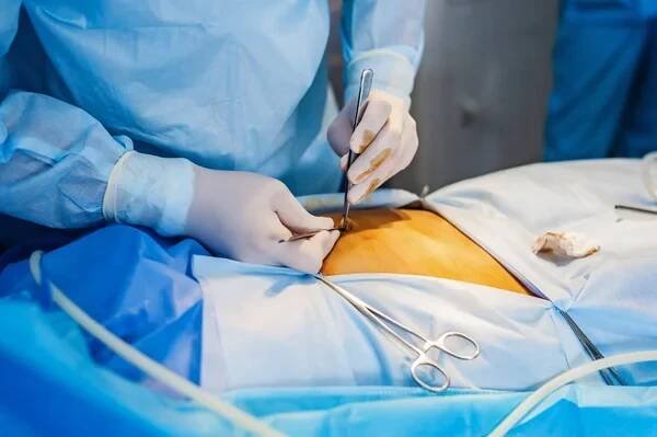 Operace pomocí endoskopie v gynekologii — Stock obrázek