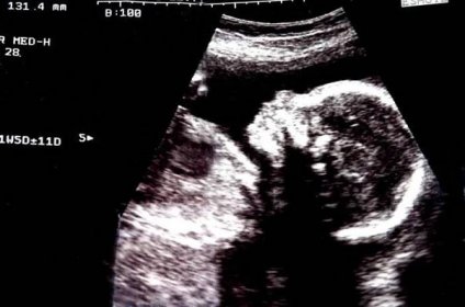 Druhý trimestr těhotenství – co vás během něj čeká?