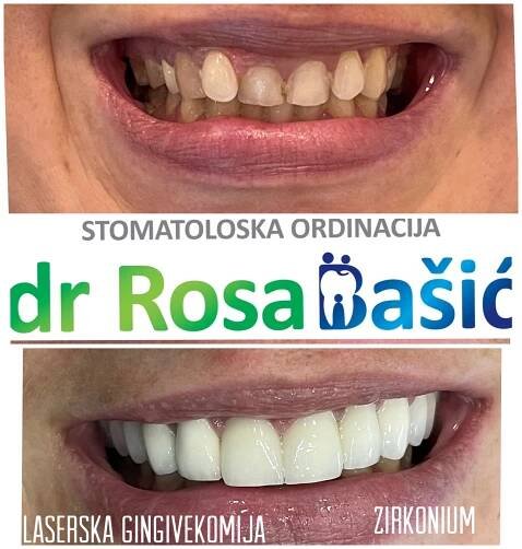 Before & After - Dental Office Dr Rosa Bašić