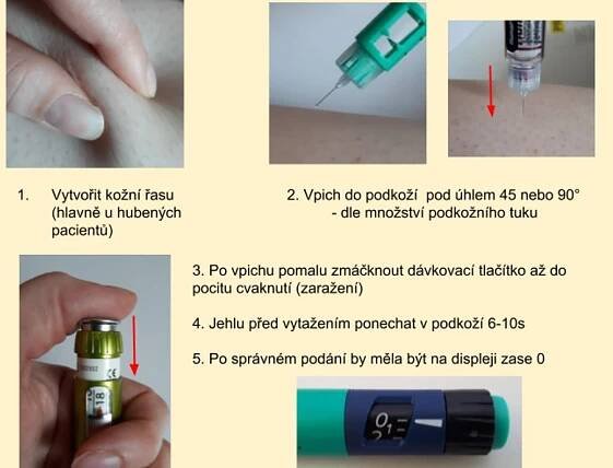 Jak aplikovat inzulin | cukrovka