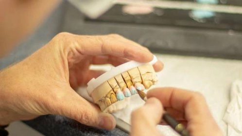Zubní technik – špatně placené zaměstnání - Seznam Médium