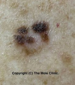The Mole Clinic