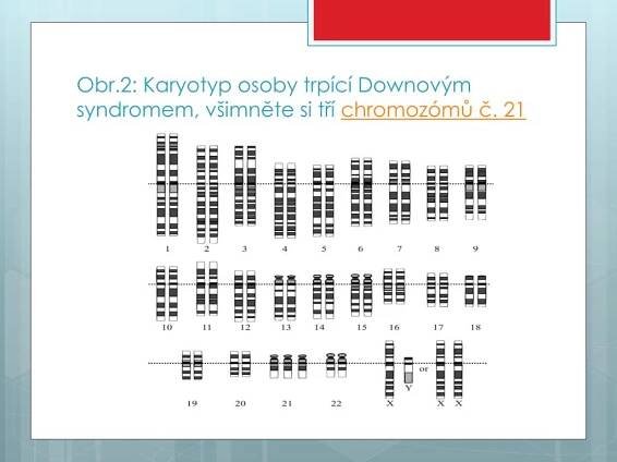 PPT - Příčiny nemocí PowerPoint Presentation, free download - ID:4034572