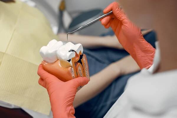 Endodoncie - Eurodent - síť zubních klinik