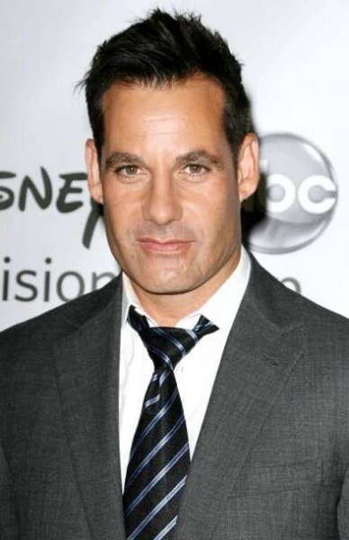 Adrian Pasdar-12 Celebrities With Scars And Deformities