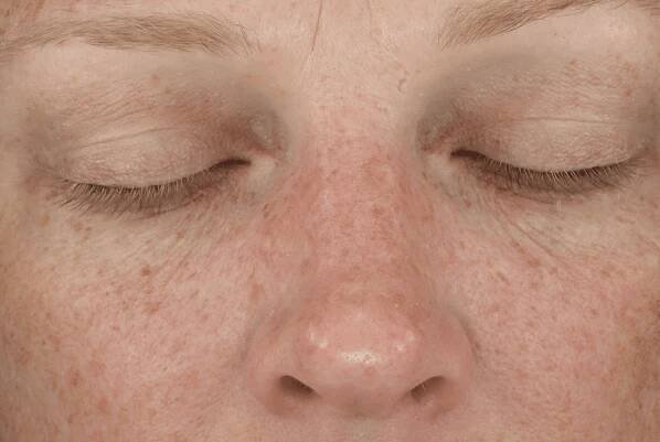 Diamond Glow Facial