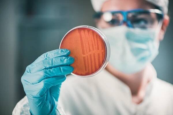 mikrobiolog kontroluje petriho misku, pozoruje růst bakterií - zlatý stafylokok - stock snímky, obrázky a fotky