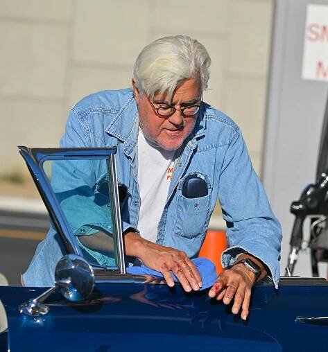 Jay Leno performing at California comedy club, two weeks after burn accident