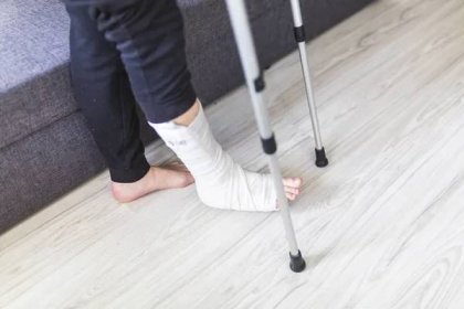 Člověk se snaží chodit se zlomenou nohou — Stock obrázek