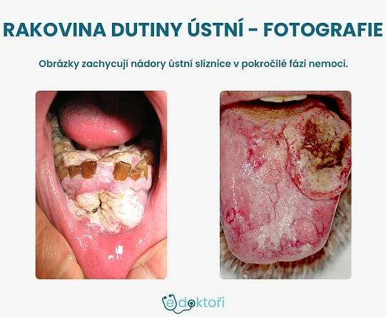 Autor: Redakce edoktori.cz