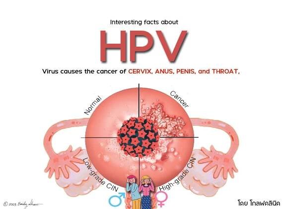 Preventing HPV Infection through Vaccination