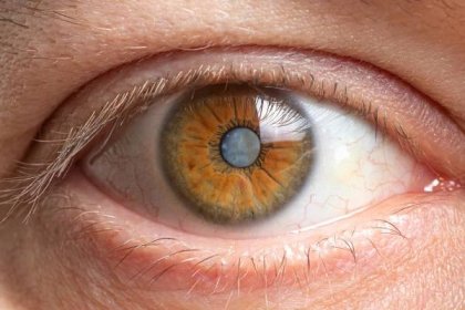 makro fotografie lidského oka - katarakta zakalení objektivu, zhoršení vidění. léčba, chirurgie a oftalmologie - glaukom - stock snímky, obrázky a fotky