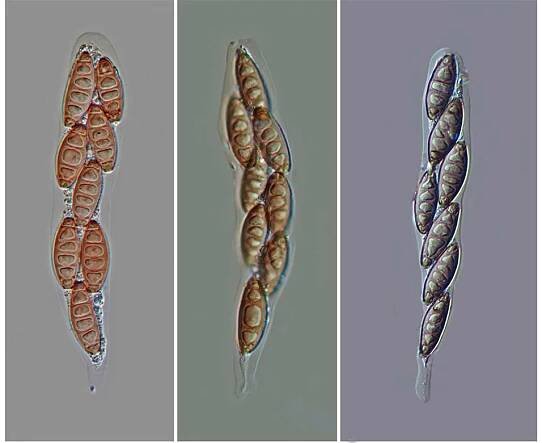 Sordariomycetes