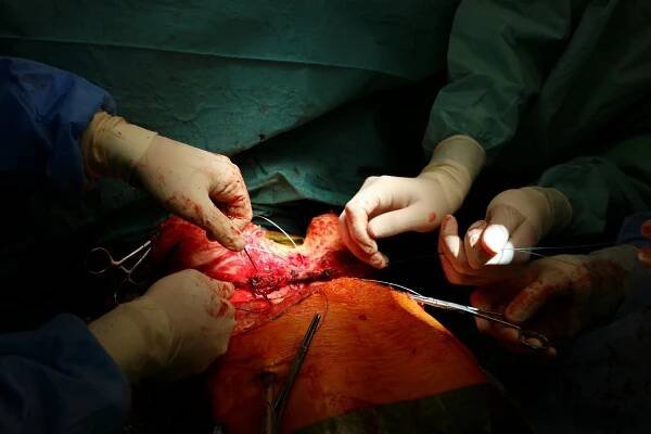 Exkluzivně: Podívejte se, jak probíhá transplantace plic