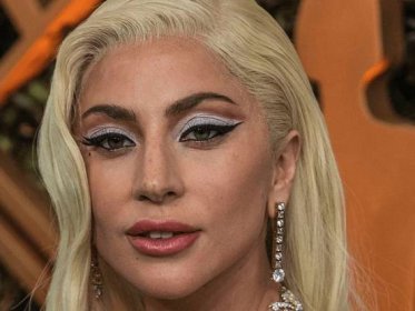 Lady Gaga Scores Major Legal Win Against Dognapping Accomplice