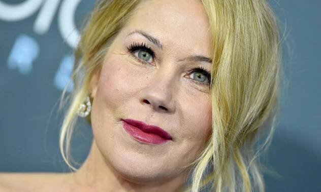 Christina Applegate Opens Up About Her Sole Plastic Surgery Experience