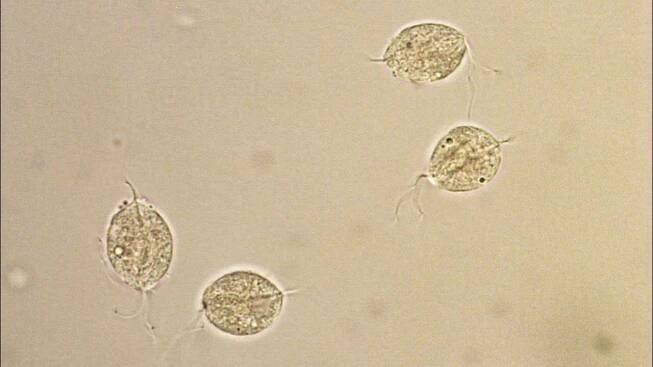 trichomonas vaginalis in urine microscopy at 40X power