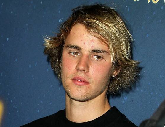Justin Bieber je po rozchodu se Selenou Gomez zničený: Stres se projevil na jeho problematické pleti